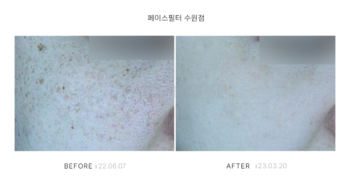 [레이저::레블라이트]